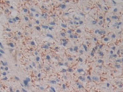 Anti-Kallikrein 2/KLK2 antibody(ab232980)