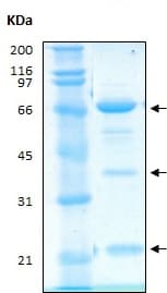 Recombinant Human PPP3CA + PPP3R1 protein(AB186081)