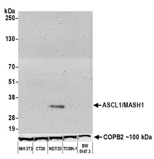 Anti-ASCL1/MASH1 antibody [BLR164J] - BSA free(AB314100)