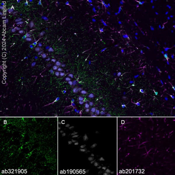 Alexa Fluor® 647 Anti-NeuN antibody [EPR12763] - Neuronal Marker(AB190565)