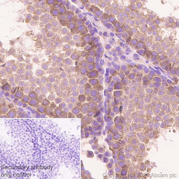 Anti-YTHDF2 antibody [EPR23544-19] - BSA and Azide free(AB275037)