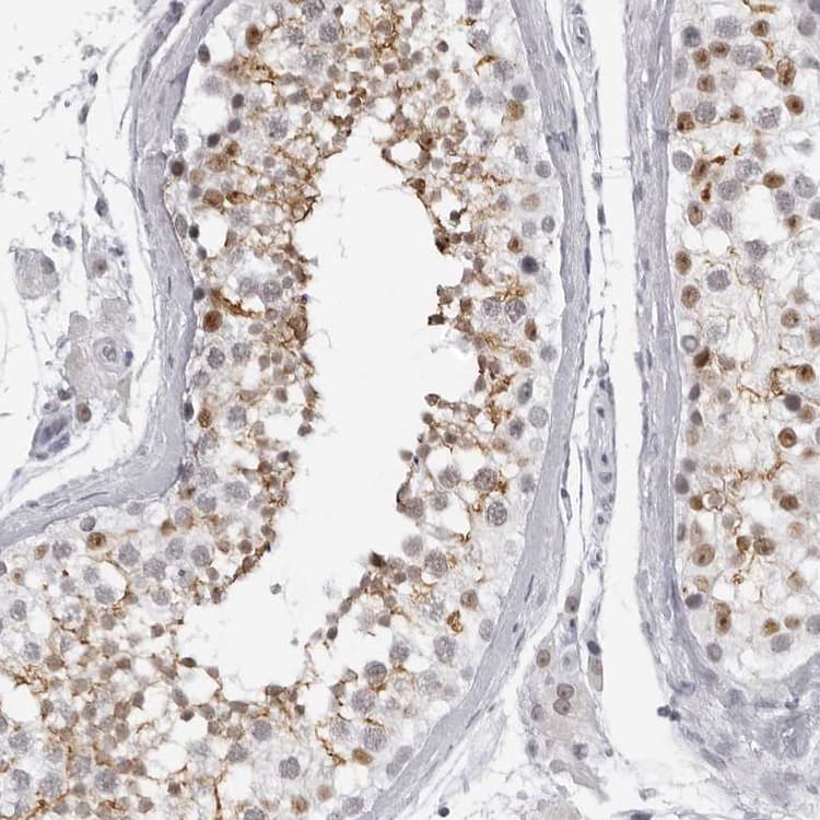Espin Antibody Ab254774  Immunohistochemistry Formalin Pfa Fixed Paraffin Embedded Sections Img23143