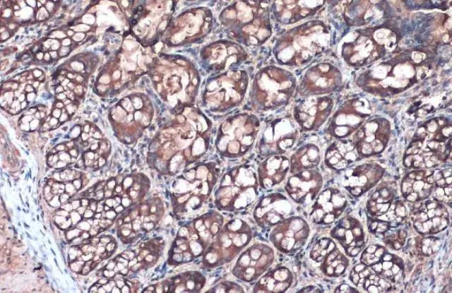 Anti-Villin antibody(AB97512)