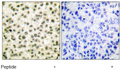 Ku70 Ku80 Antibody Ab53126  Immunohistochemistry Formalin Pfa Fixed Paraffin Embedded Sections Img57334