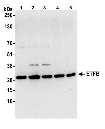 Anti-ETFB antibody(AB240593)