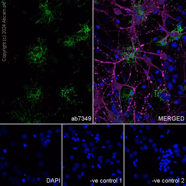 Confocal microscopy image of mouse primary neural/glia cells stained for Myelin Basic Protein (green), MAP2 (magenta), and nuclei (blue).