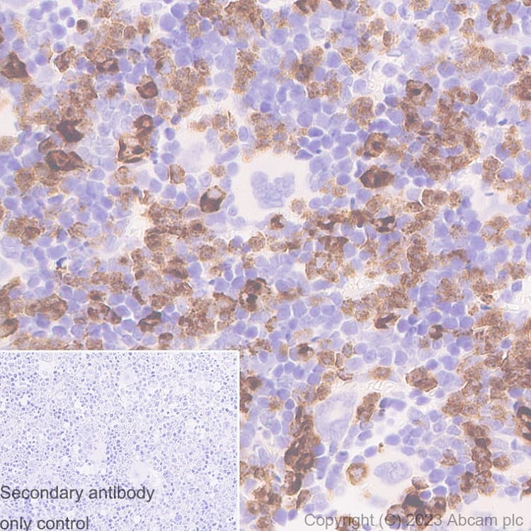 Anti-Neutrophil Elastase antibody [RM1077](AB314916)