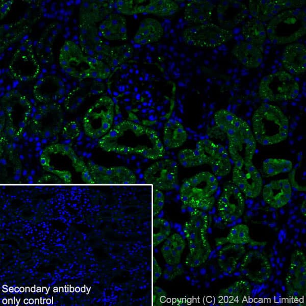 Anti-Cathepsin L/MEP antibody [EPR29413-573](AB321872)