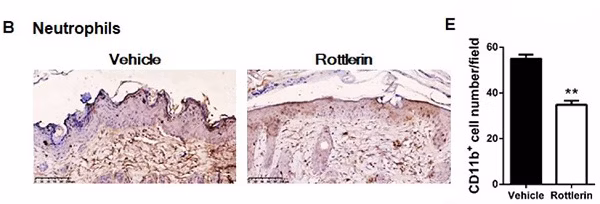 IHC image showing decreased CD11b-positive cells in rottlerin-treated mice compared to vehicle-treated mice.