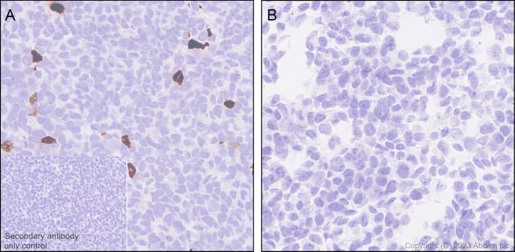 Anti-Aggrecan antibody [EPR28034-86](AB313636)