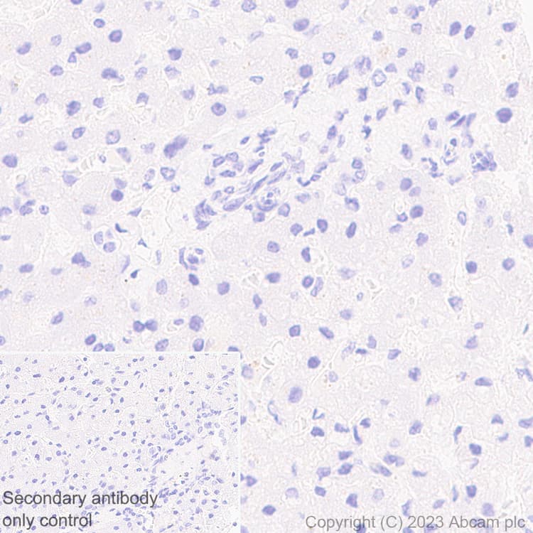 Anti-Rfx Cas13d (N-term) antibody [EPR23965-31](AB314741)