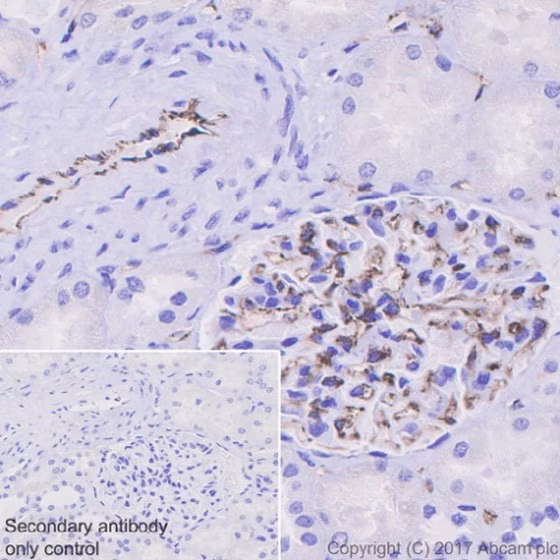 Immunohistochemical analysis of human kidney tissue labeling CD31, showing membranous staining on endothelial cells.