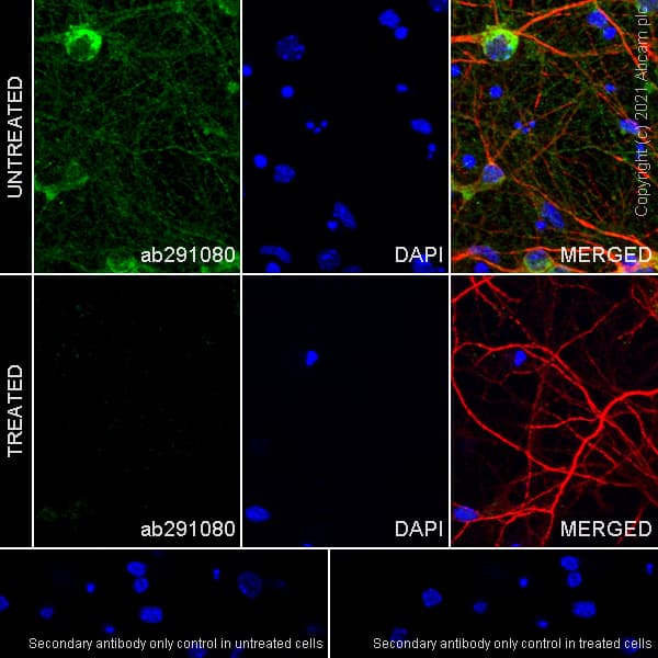 Anti-Tau (phospho T217) antibody [EPR24654-110](AB291080)