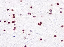 Anti-SF3B1 antibody [EPR11986](AB172634)