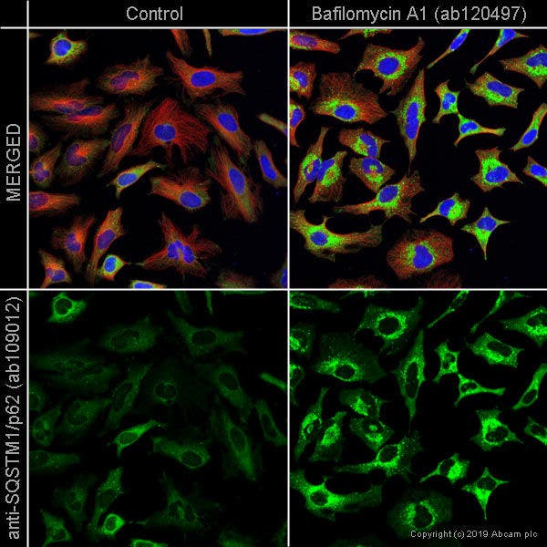 Confocal microscopy image comparing SQSTM1/p62 staining in control HeLa cells and HeLa cells treated with bafilomycin A1.