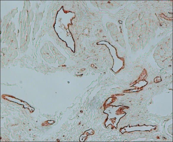 Anti-Von Willebrand Factor antibody(ab6994)