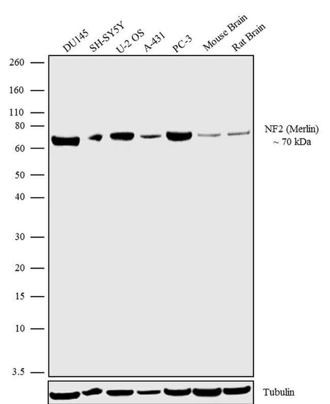 Anti-NF2 / Merlin antibody [RP23040199](AB308025)