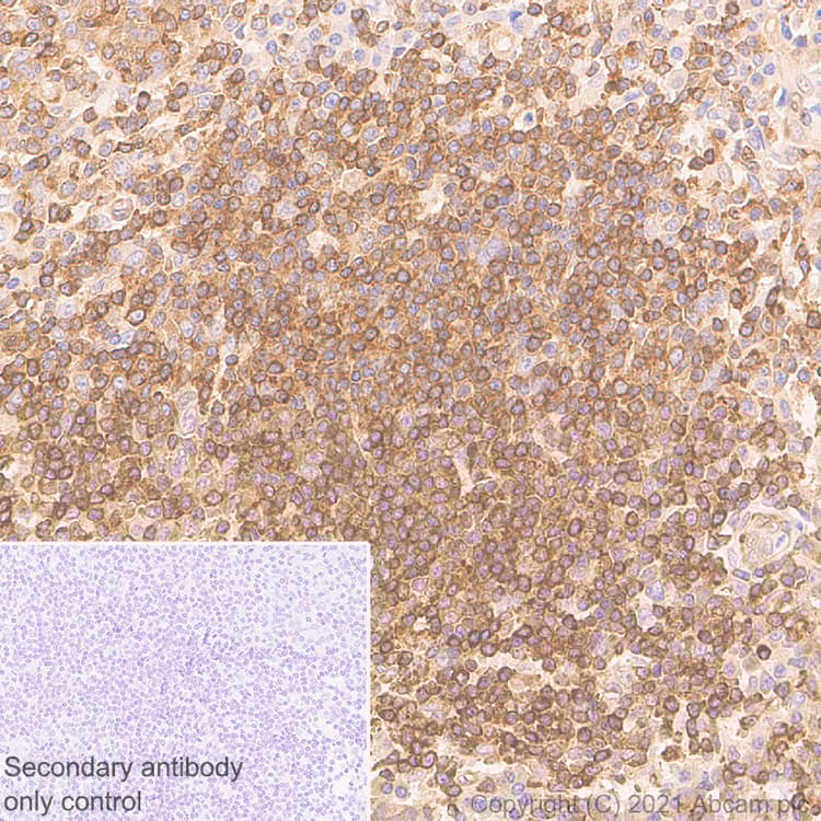 Anti-NF-kB p65 antibody [E379](AB32536)