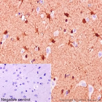 S100 beta protein expression in human cerebral cortex tissue
