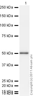 Recombinant Human NSE protein(ab78797)