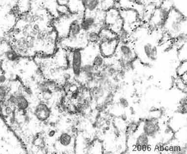 Electron Microscopy - Anti-GFP Antibody (ab6556)