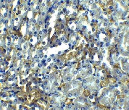 Anti-RIP antibody(AB106393)