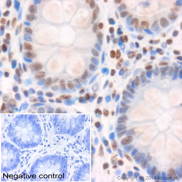 Immunohistochemistry image of ab8580 staining Histone H3 (tri methyl K4) in human colon FFPE tissue, performed on Leica Bond system.