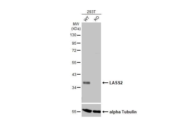 Lass2 Antibody Hl1717 Ab308189  Western Blot Img429487