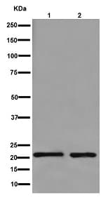 Lhfpl5 Antibody Epr16285 C Terminal Ab192242  Western Blot Img61449