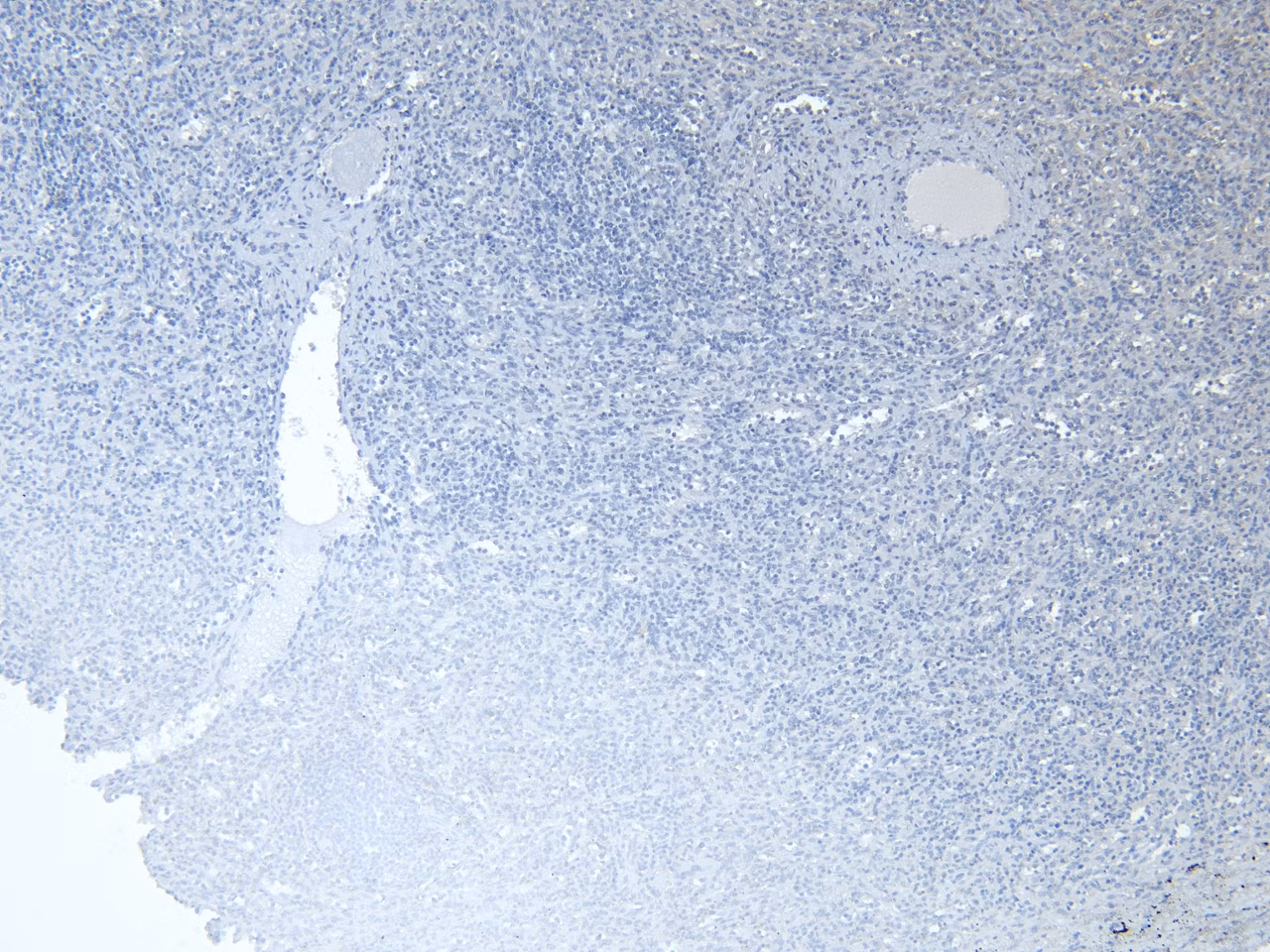 Negative control immunohistochemistry of human spleen tissue showing no Iba1 labeling without primary antibody.