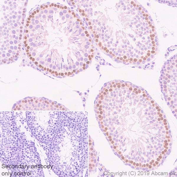 Anti-DMC1 antibody [EPR23207-130](AB245217)