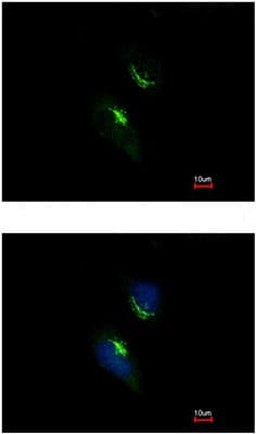 Prps1 Antibody Ab137577  Immunocytochemistry Immunofluorescence Img63149