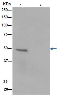 Anti-alpha Sarcoglycan antibody [EPR14773](AB189254)