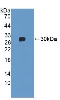 Anti-Cardiac Troponin I antibody(AB231064)