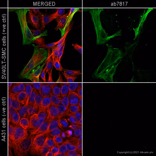 Confocal microscopy image showing alpha smooth muscle actin staining (green) in SV40LT-SMC cells (positive control) and A431 cells (negative control). Beta tubulin (red) and nuclear DNA (blue) are also stained.
