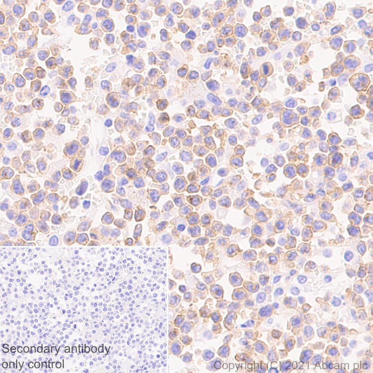 Anti-IL2 Receptor beta/p75 antibody [EPR24336-29](AB271040)