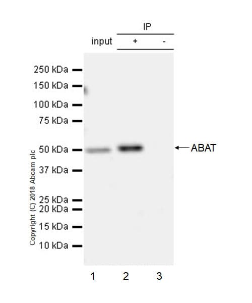 Abat Gaba T Antibody Epr20842 Bsa And Azide Free Ab233702  Immunoprecipitation Img3691