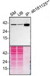 Anti-STING antibody [EPR13130] - BSA and Azide free(AB227128)