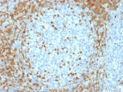 Zap70 Antibody Zap70 2035 Ab238076  Immunohistochemistry Formalin Pfa Fixed Paraffin Embedded Sections Img38129