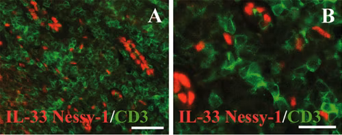 Immunohistochemical analysis of human tonsil tissue, staining CD3 epsilon (green) with ab16669.