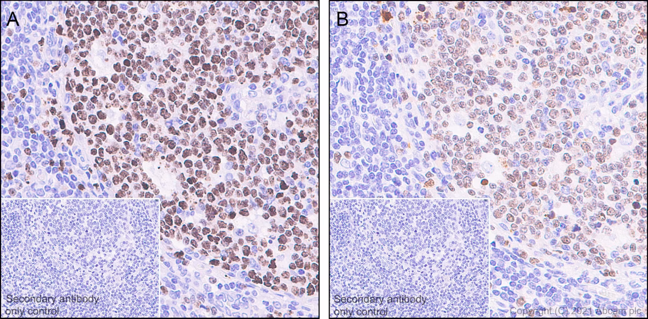 Immunohistochemical staining of human tonsil sections showing Ki67 labeling using ab16667 antibody at 1/200 (0.156 μg/mL).