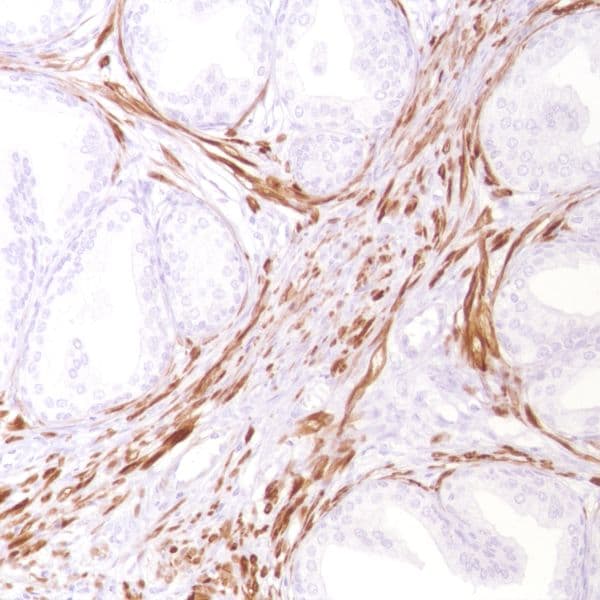 Anti-Calponin 1 antibody [SP180] - C-terminal(AB227660)