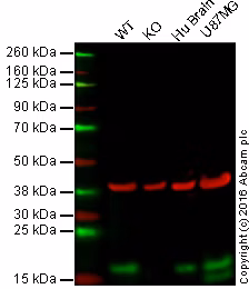 Western blot - Anti-LC3B antibody [EPR18709] - Autophagosome Marker (ab192890). Lane 1: 20 μg wild-type HAP1 cell lysate; Lane 2: 20 μg LC3B knockout HAP1 cell lysate; Lane 3: 20 μg human brain tissue lysate; Lane 4: 20 μg U-87 MG cell lysate.