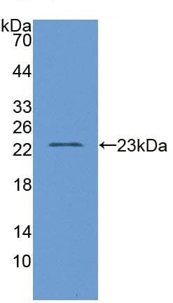 Anti-D2HGDH antibody(AB233516)