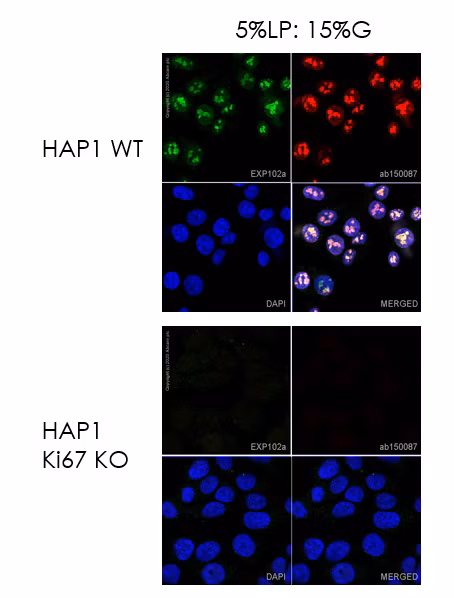 Direct immunofluorescent staining with recombinant anti-Ki67 antibody (ab209897) labeled using Alexa Fluor® 488 conjugation kit (ab236553)