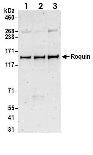 Anti-RC3H1 antibody(ab70195)