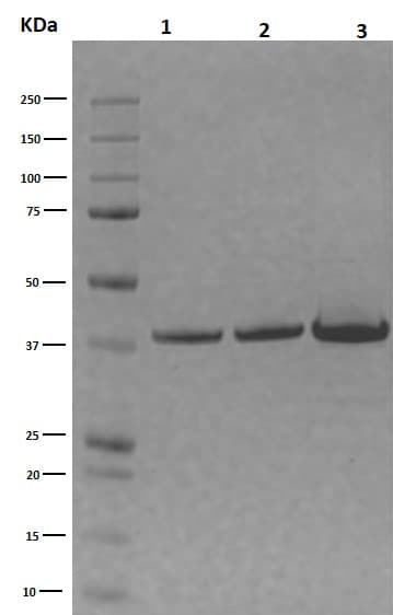 Recombinant Human Apolipoprotein E4(AB123766)