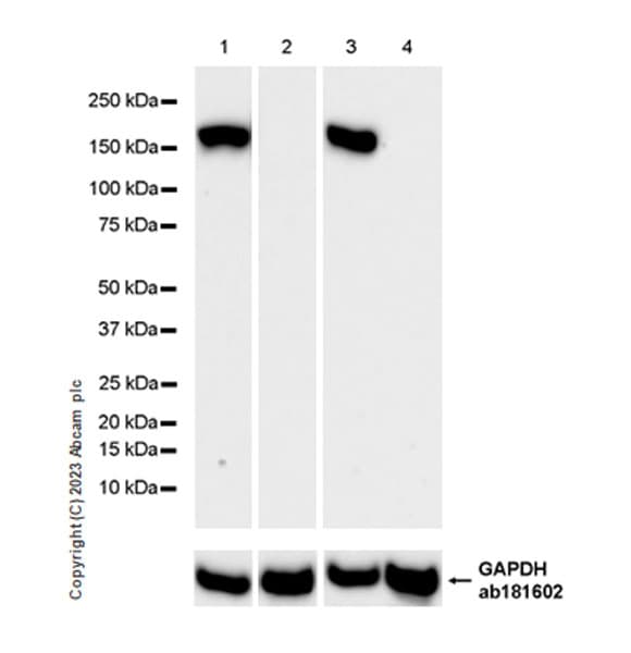Anti-MYBPC3 antibody [EPR25673-58](AB308619)