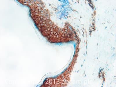Cd1d Antibody Nor32 Nor32 1317 Ab11076  Immunohistochemistry Formalin Pfa Fixed Paraffin Embedded Sections Img47375