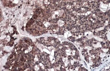 Rip3 Antibody Ab246523  Immunohistochemistry Formalin Pfa Fixed Paraffin Embedded Sections Img451460